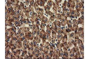 Image no. 6 for anti-Histone Deacetylase 6 (HDAC6) antibody (ABIN1498618)