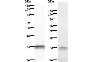 Left: BCL3 staining.