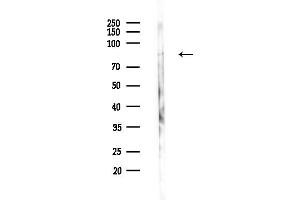 anti-G-Elongation Factor, Mitochondrial 1 (GFM1) (C-Term) antibody