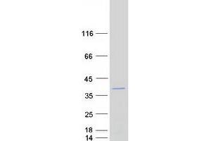 Validation with Western Blot