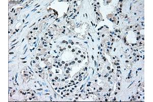 Image no. 10 for anti-B-Raf proto-oncogene, serine/threonine kinase (BRAF) antibody (ABIN1496961)