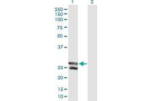 Lane 1: C12orf72 transfected lysate ( 29.