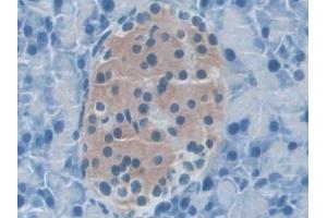 Detection of NLRP3 in Mouse Pancreas Tissue using Polyclonal Antibody to NLR Family, Pyrin Domain Containing Protein 3 (NLRP3)