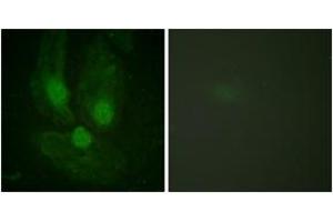 Immunofluorescence analysis of HeLa cells, using PKC zeta (Ab-410) Antibody. (PKC zeta anticorps  (AA 376-425))