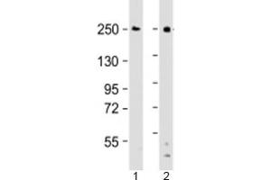 Western blot testing of human 1) Ramos and 2) THP-1 cell lysate with DOCK8 antibody at 1:2000. (DOCK8 anticorps  (AA 2056-2090))