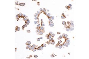 Immunocytochemistry (ICC) image for anti-Epithelial Cell Adhesion Molecule (EPCAM) (AA 264-314) antibody (ABIN7455204) (Recombinant EpCAM anticorps  (AA 264-314))