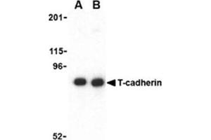 Image no. 1 for anti-Cadherin 13 (CDH13) (N-Term) antibody (ABIN318711) (Cadherin 13 anticorps  (N-Term))