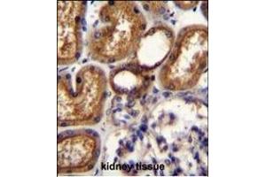 WT1 Antibody (Center ) (ABIN655904 and ABIN2845304) immunohistochemistry analysis in formalin fixed and paraffin embedded human kidney tissue followed by peroxidase conjugation of the secondary antibody and DAB staining.