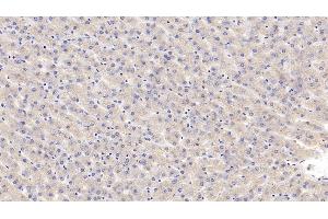Detection of CALR in Human Liver Tissue using Polyclonal Antibody to Calreticulin (CALR) (Calreticulin anticorps  (AA 18-193))