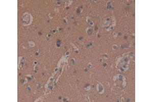 Used in DAB staining on fromalin fixed paraffin- embedded brain tissue (PDE10A anticorps  (AA 508-779))