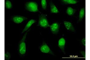 Immunofluorescence of monoclonal antibody to UBE2N on HeLa cell. (UBE2N anticorps  (AA 1-152))