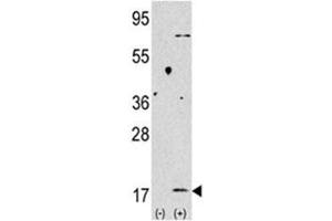 Western blot analysis of LC3B antibody and 293 lysate transiently transfected with the MAP1LC3B gene (2ug/lane).