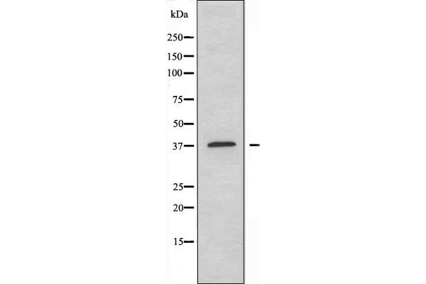 NT5C3 antibody  (N-Term)