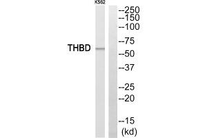 Western blot analysis of extracts from K562 cells, using THBD antibody. (Thrombomodulin anticorps  (C-Term))