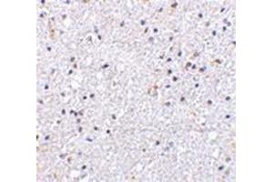 Immunohistochemistry of VISA in human brain tissue with this product at 5 μg/ml. (MAVS anticorps  (N-Term))