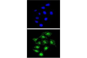 Confocal immunofluorescent analysis of CBFB Antibody (Center) (ABIN390892 and ABIN2841100) with 293 cell followed by Alexa Fluor® 488-conjugated goat anti-rabbit lgG (green). (CBFB anticorps  (AA 61-90))
