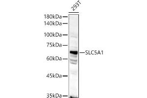 Western blot analysis of extracts of 293T cells, using SLC5 antibody (1976) at 1:500 dilution. (SLC5A1 anticorps  (AA 350-450))
