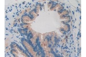 Detection of BMP15 in Rat Lung Tissue using Polyclonal Antibody to Bone Morphogenetic Protein 15 (BMP15)