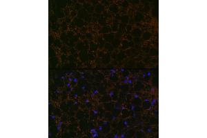 Immunofluorescence analysis of rat fat using Perilipin A Rabbit mAb (ABIN7269218) at dilution of 1:100 (40x lens). (PLIN1 anticorps)