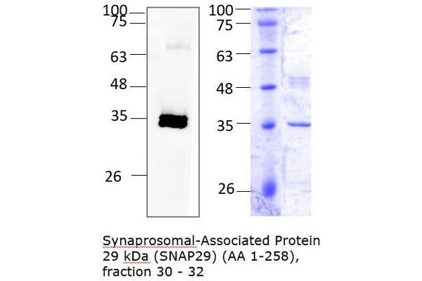 SNAP29 Protein (AA 1-258) (His tag)
