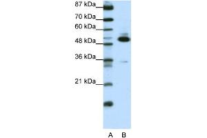 WB Suggested Anti-TADA3L Antibody Titration:  0. (TADA3L anticorps  (C-Term))