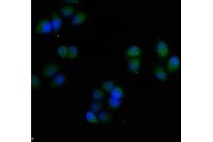 Immunofluorescence staining of Hela cells with ABIN7166066 at 1:50, counter-stained with DAPI. (S100A7 anticorps  (AA 2-101))