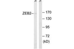 Western blot analysis of extracts from Jurkat cells, using ZEB2 Antibody. (ZEB2 anticorps  (AA 71-120))