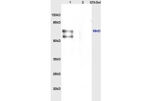 Lane 1: mouse brain lysates Lane 2: mouse heart lysates probed with Anti CHRNA4 Polyclonal Antibody, Unconjugated (ABIN736746) at 1:200 in 4 °C.