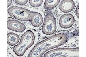 Expression of TRPM5 in rat testes - Immunohistochemical staining of rat epididymis paraffin embedded sections using Anti-TRPM5 Antibody (ABIN7043834, ABIN7044010 and ABIN7044011), (1:100).