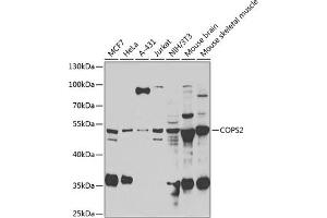 Western blot analysis of extracts of various cell lines, using COPS2 antibody (ABIN6130123, ABIN6138877, ABIN6138878 and ABIN6222819) at 1:1000 dilution. (COPS2 anticorps  (AA 1-310))