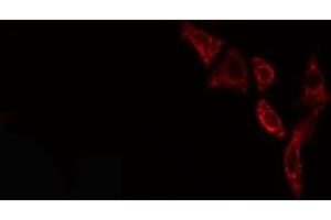 ABIN6276596 staining NIH-3T3 cells by IF/ICC. (PDGFB anticorps  (N-Term))