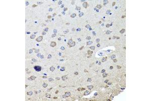 Immunohistochemistry of paraffin-embedded mouse brain using CHRNB2 antibody (ABIN6003540) at dilution of 1/100 (40x lens).