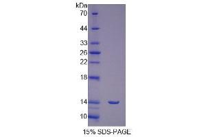 SDS-PAGE analysis of Human FSHR Protein. (FSHR Protéine)