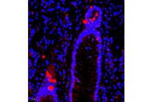 Immunofluorescence of paraffin embedded human colon using SRP14 (ABIN7075596) at dilution of 1:300 (400x lens)