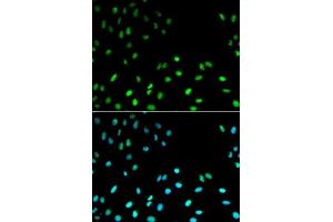 Immunofluorescence analysis of MCF-7 cells using RFC1 antibody. (RFC1 anticorps  (AA 400-700))