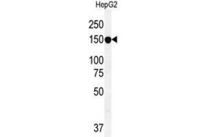 ABCC10 Antibody (ABCC10 anticorps  (Middle Region))