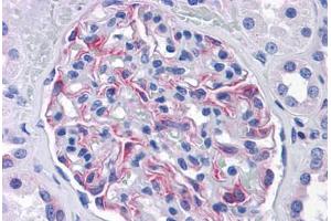 Human Kidney: Formalin-Fixed, Paraffin-Embedded (FFPE)