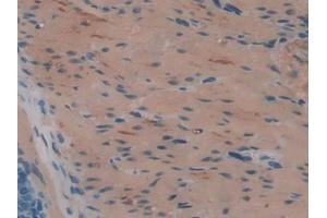 IHC-P analysis of Rat Stomach Tissue, with DAB staining. (HAO1 anticorps  (AA 102-357))