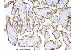 IHC analysis of Cyclophilin B using anti-Cyclophilin B antibody .