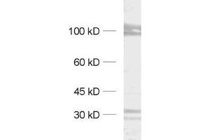 dilution: 1 : 1000, sample: synaptic membrane fraction (LP1)