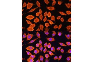 Immunofluorescence analysis of L929 cells using SI Rabbit pAb (ABIN3016131, ABIN3016132, ABIN3016133 and ABIN6219568) at dilution of 1:100.