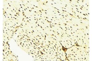 ABIN6276514 at 1/100 staining Mouse liver tissue by IHC-P.