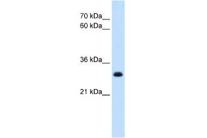 WB Suggested Anti-TAL1 Antibody   Titration: 5 ug/ml   Positive Control: HepG2 Whole Cell (TAL1 anticorps  (Middle Region))