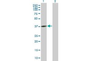 Western Blot analysis of CLEC10A expression in transfected 293T cell line by CLEC10A MaxPab polyclonal antibody. (CLEC10A anticorps  (AA 1-316))