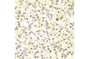 Immunohistochemistry (IHC) image for anti-Damage-Specific DNA Binding Protein 2, 48kDa (DDB2) (AA 1-315) antibody (ABIN3022632)