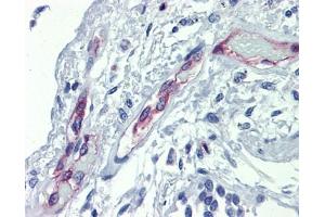 EHD4 antibody was used for immunohistochemistry at a concentration of 4-8 ug/ml. (EHD4 anticorps  (Middle Region))