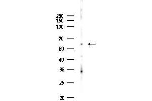 anti-Baculoviral IAP Repeat Containing 2 (BIRC2) (C-Term) antibody