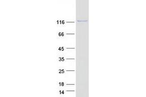 Validation with Western Blot