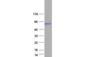 Validation with Western Blot