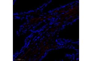 Immunofluorescence of paraffin embedded human prostate using paldadin (ABIN7074976) at dilution of 1: 500 (300x lens)
